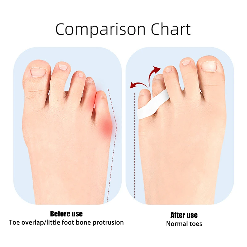 Corretor de silicone para hálux valgo, gel para cuidados com os pés, separador de dedos pequenos, protetor de joanete, pedicure, 1 par