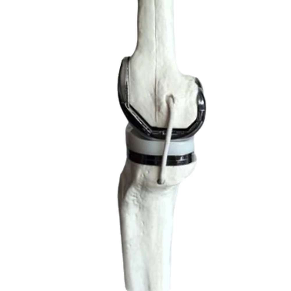 【Measuring】 Knee Joint Model Simulation Replacement Surgery Meniscus Ligament Cartilages Surgery Model,Artificial Knee Joint