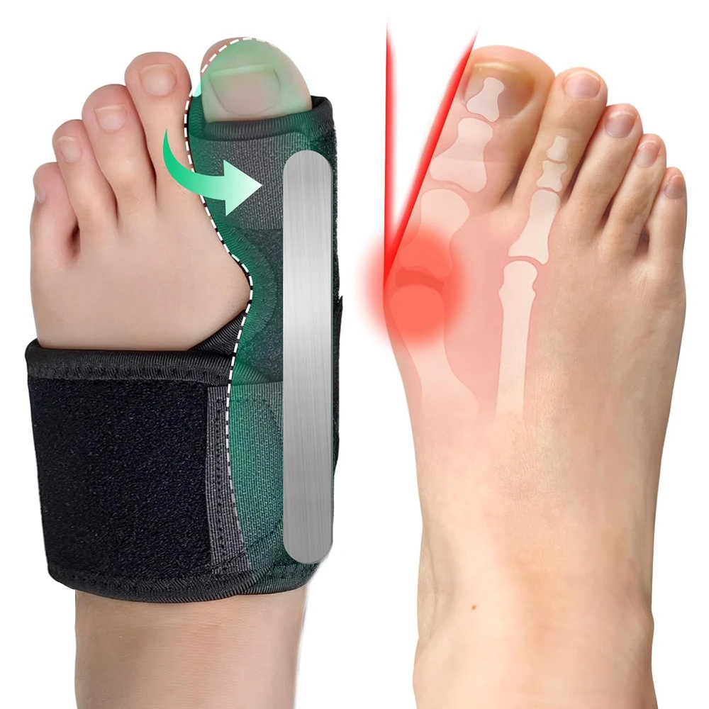  1/2 Stück Bunion Brace – Glätteisen mit großer Zehenkorrektur und Schiene – orthopädische Ärmel-Fußwickelunterstützung für Männer und Frauen – Detail 1