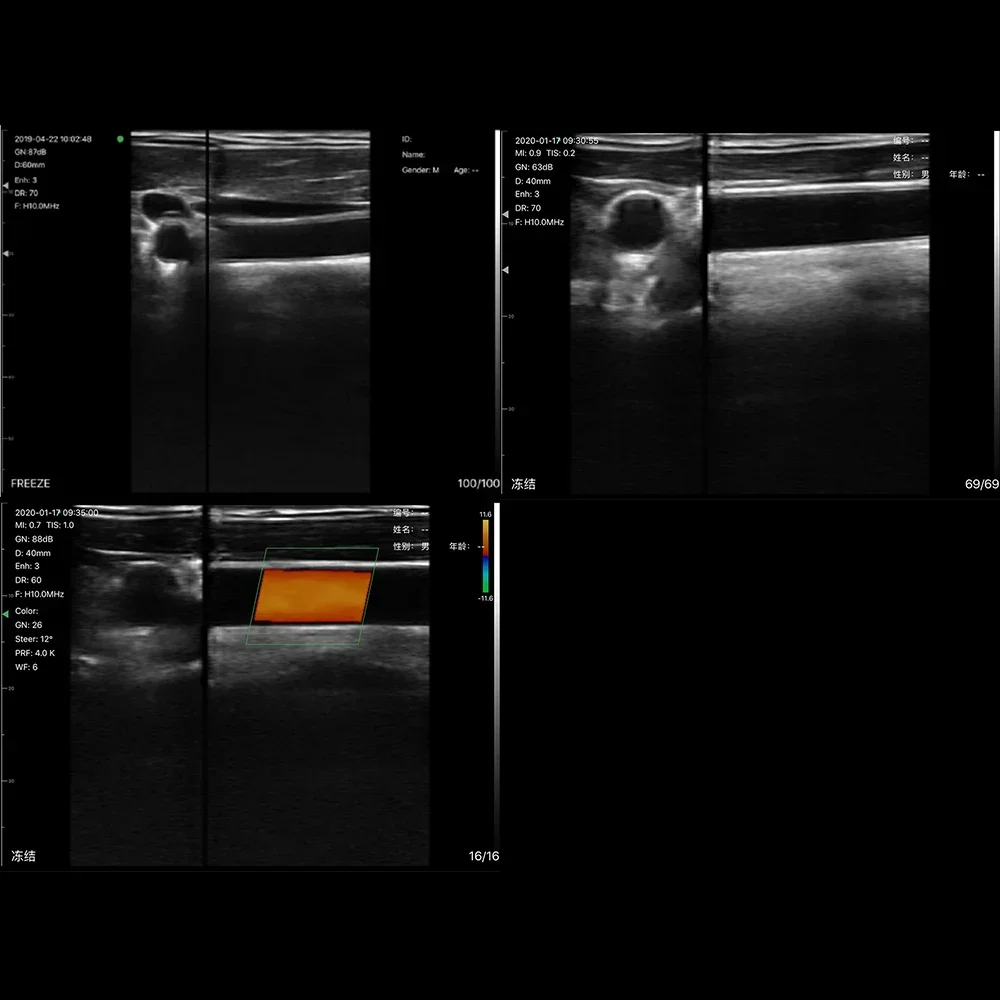 Amain Magiq Mcucl Fabricage Prijs Van Zwangerschap Ultrasound Machine Lineaire & Bolle Dual Probe Android Ultrasound Scanner