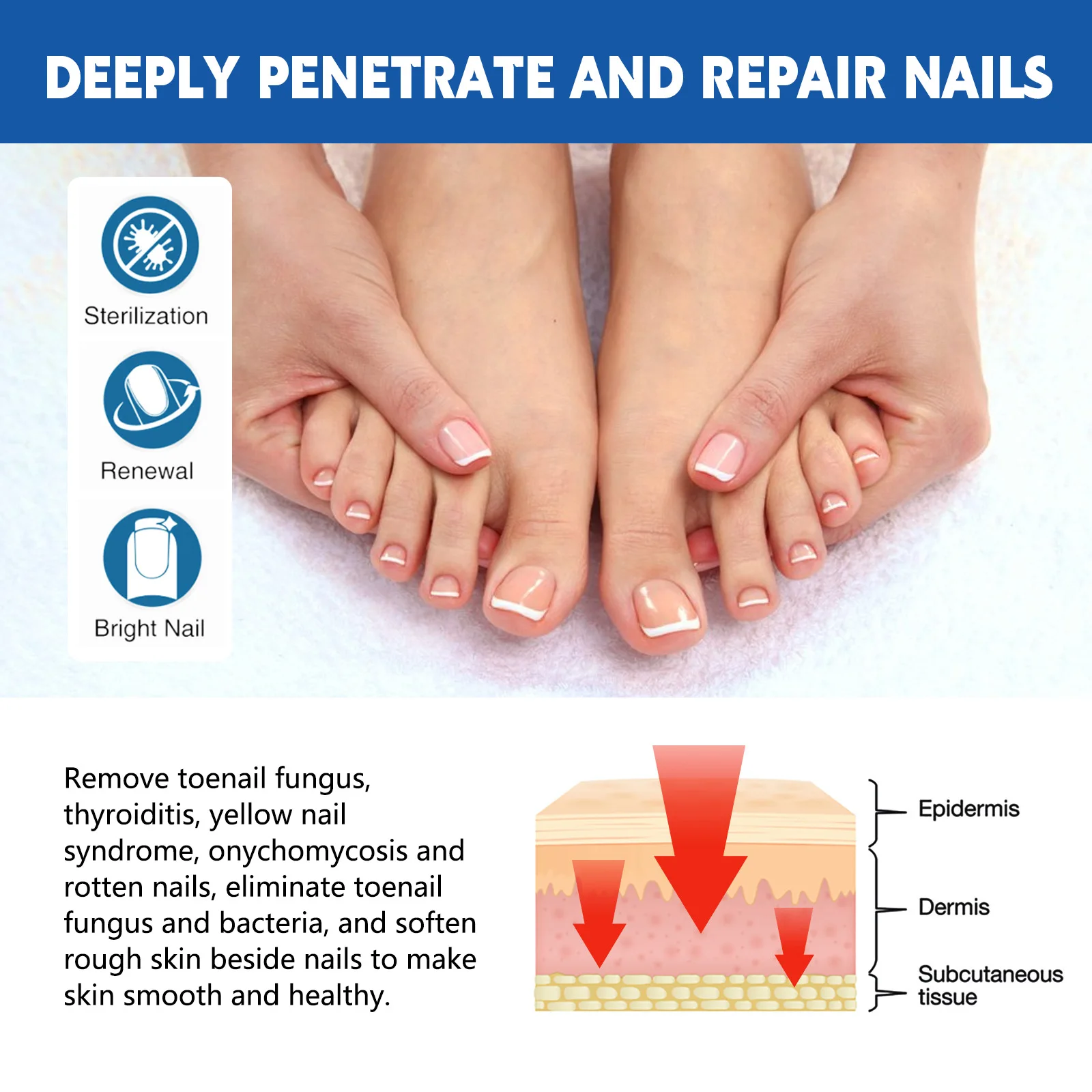 20pcs/box Nail Treatment Patch Anti Fungal Nail Correction Stickers Ingrown Toenail Care Paronychia Anti Infection Repair Patch