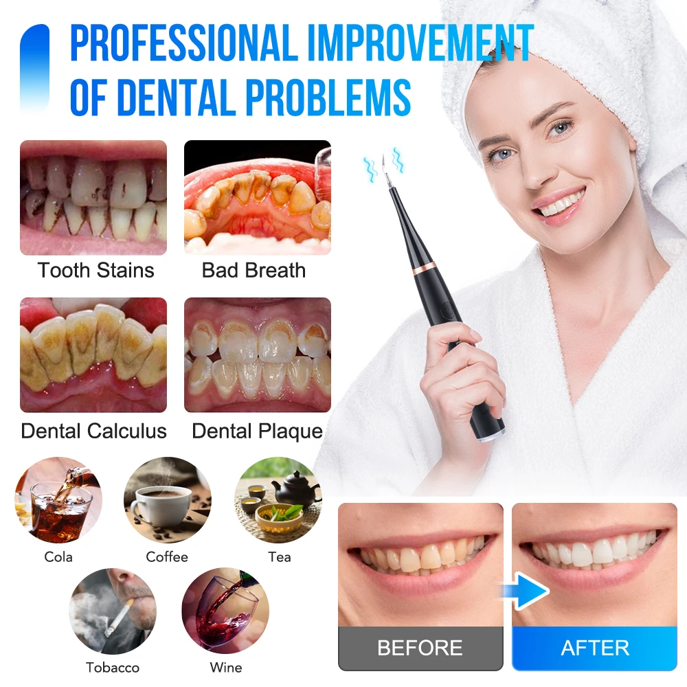 Electric Toothbrush Sonic Dental Teeth Whitening Kit Tooth Whitener Calculus Tartar Remover Tools Cleaner Stain Oral Care
