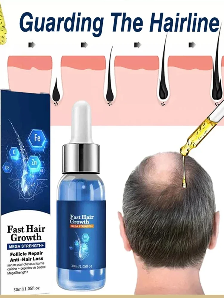 

Effective Fast Hair Growth Oil Baldness Repair Hereditary Postpartum Seborrheic Anti Loss