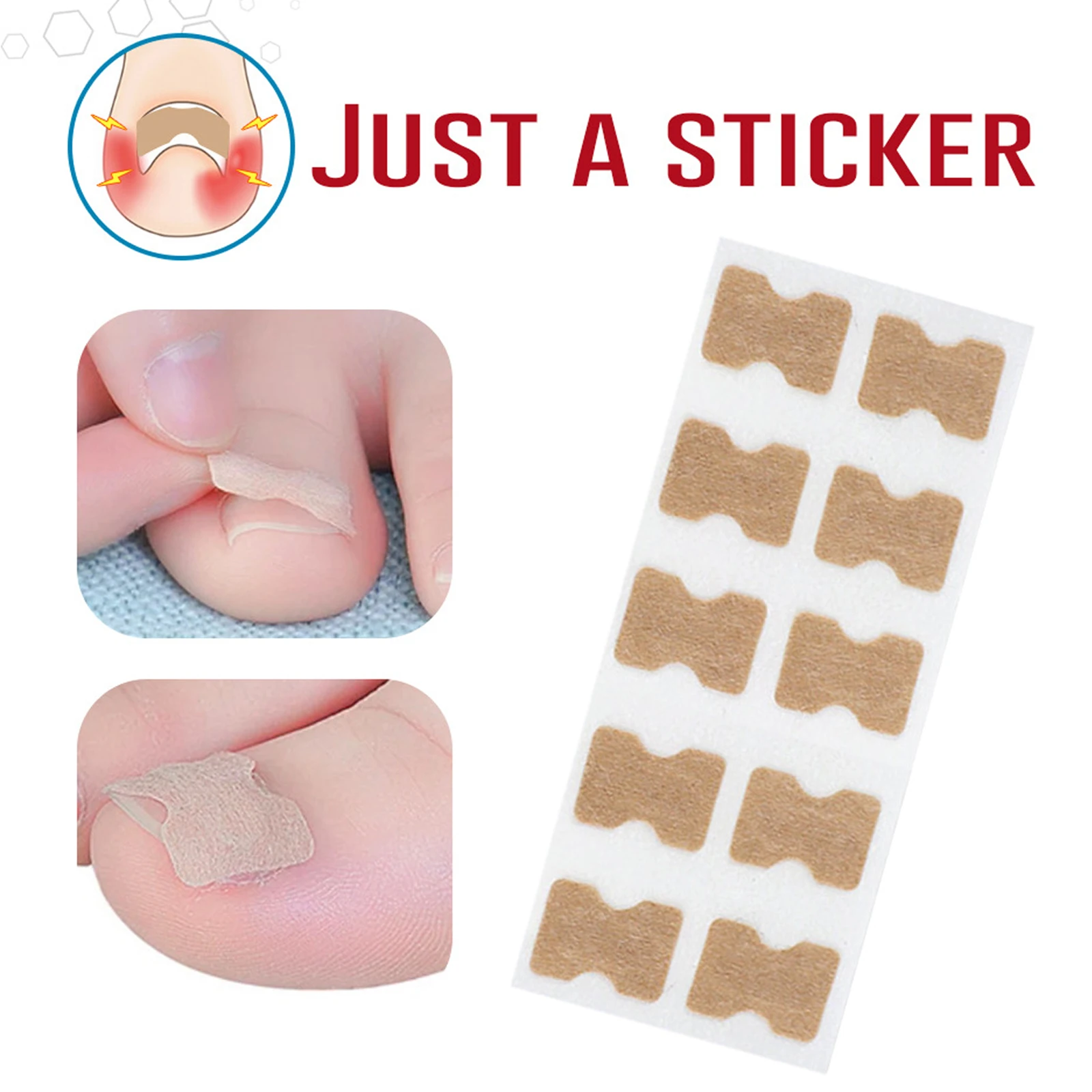 1 sheet Nail Art Ingrown Correction Sticker Foot Care Pedicure Tool Fixer Paronychia Recover Toenail Elastic Patch Corrector