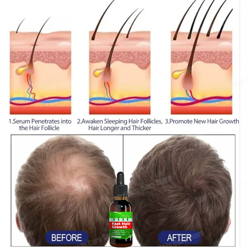 

Prevent shedding, reduce hair loss, hair growth,