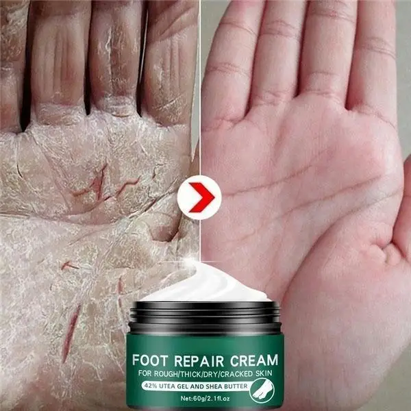 Newest Hand and Foot Skin Repairing Moisturizer Cream Anti-Chapping for Rough Dry and Cracked Chapped Feet Heel Repair Foot