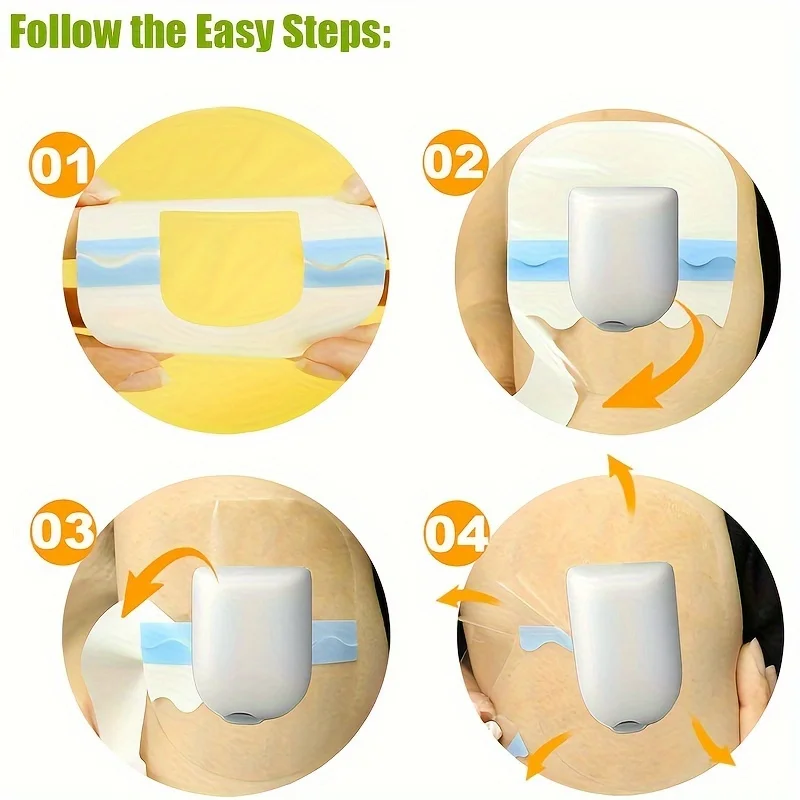 Omnipod 5 Adhesive Patches: Waterproof, Sweatproof, 10-Day Long Stay, Pre-cut for Dash Pods, Hypoallergenic, Latex-free