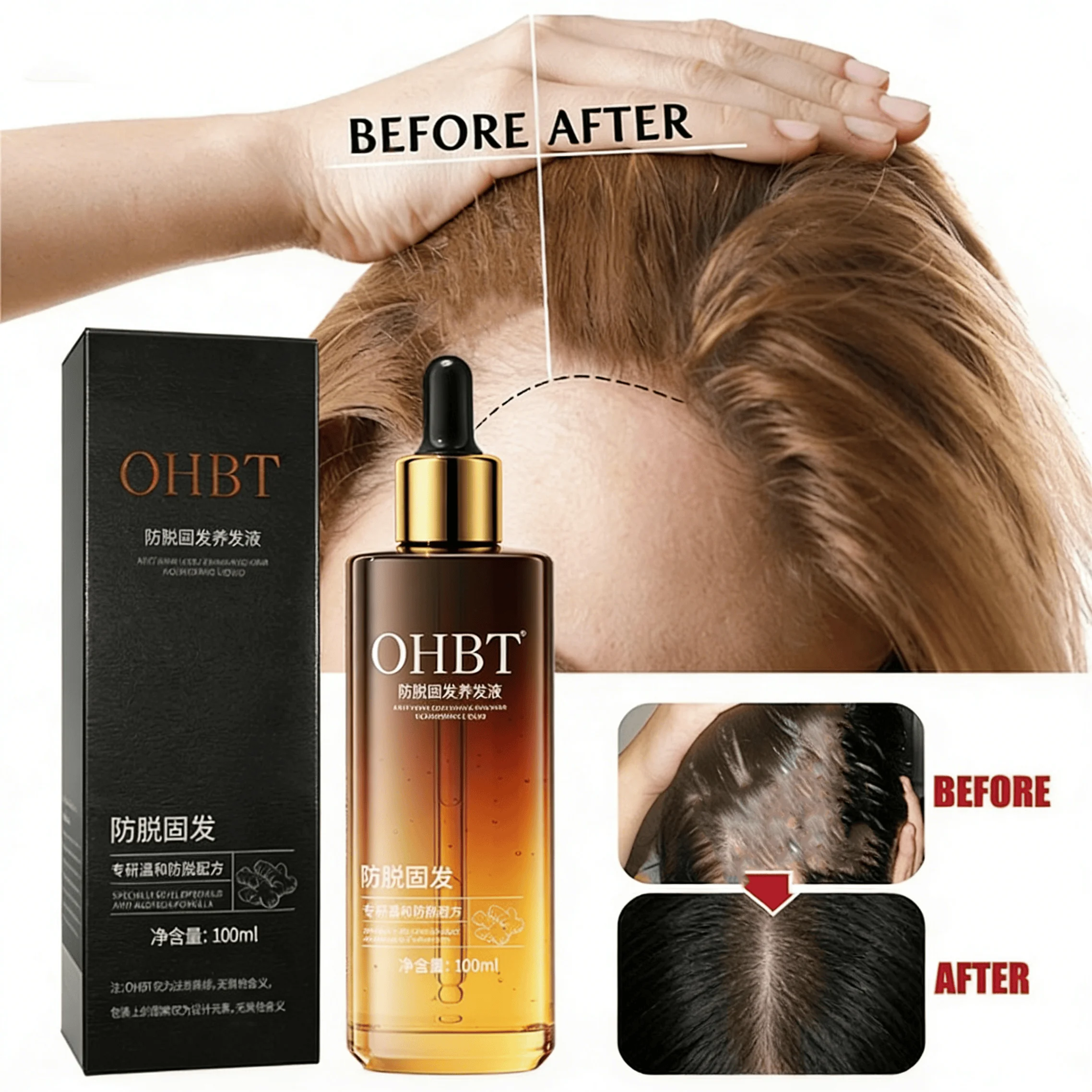 

Сыворотка для роста волос OHBT Anti-Relaxation - утолщает волосы, регулирует линию роста волос, способствует быстрому росту волос с использованием растительных питательных веществ.