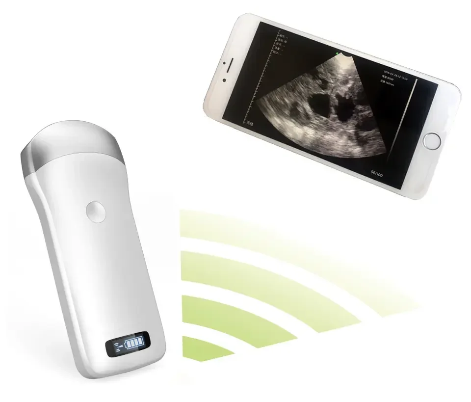 Veterinary Wireless portable type B-ultrasound handheld portable color ultrasound device with WiFi connection  for animal