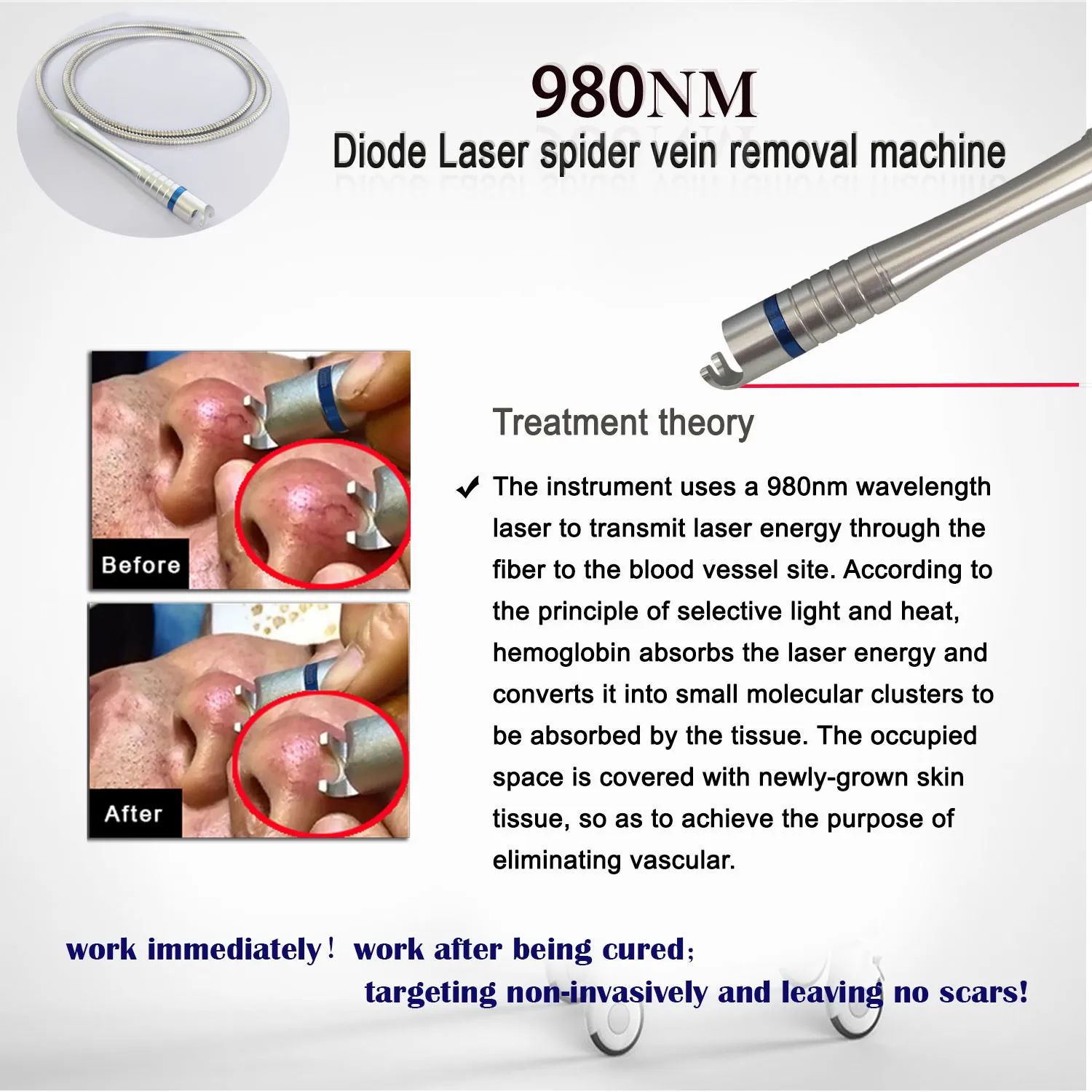 2026 New Upgrade Portable Red Blood Vessel Spider Vein Removal Capillary Removal 980nm Diode Laser Vascular Treatment Machine