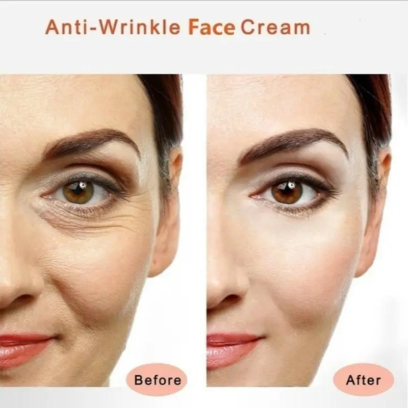 Moisturizer Cream for Face and Eye Area Remove Dark Circles Eye Bags Anti-wrinkle Firming Cream