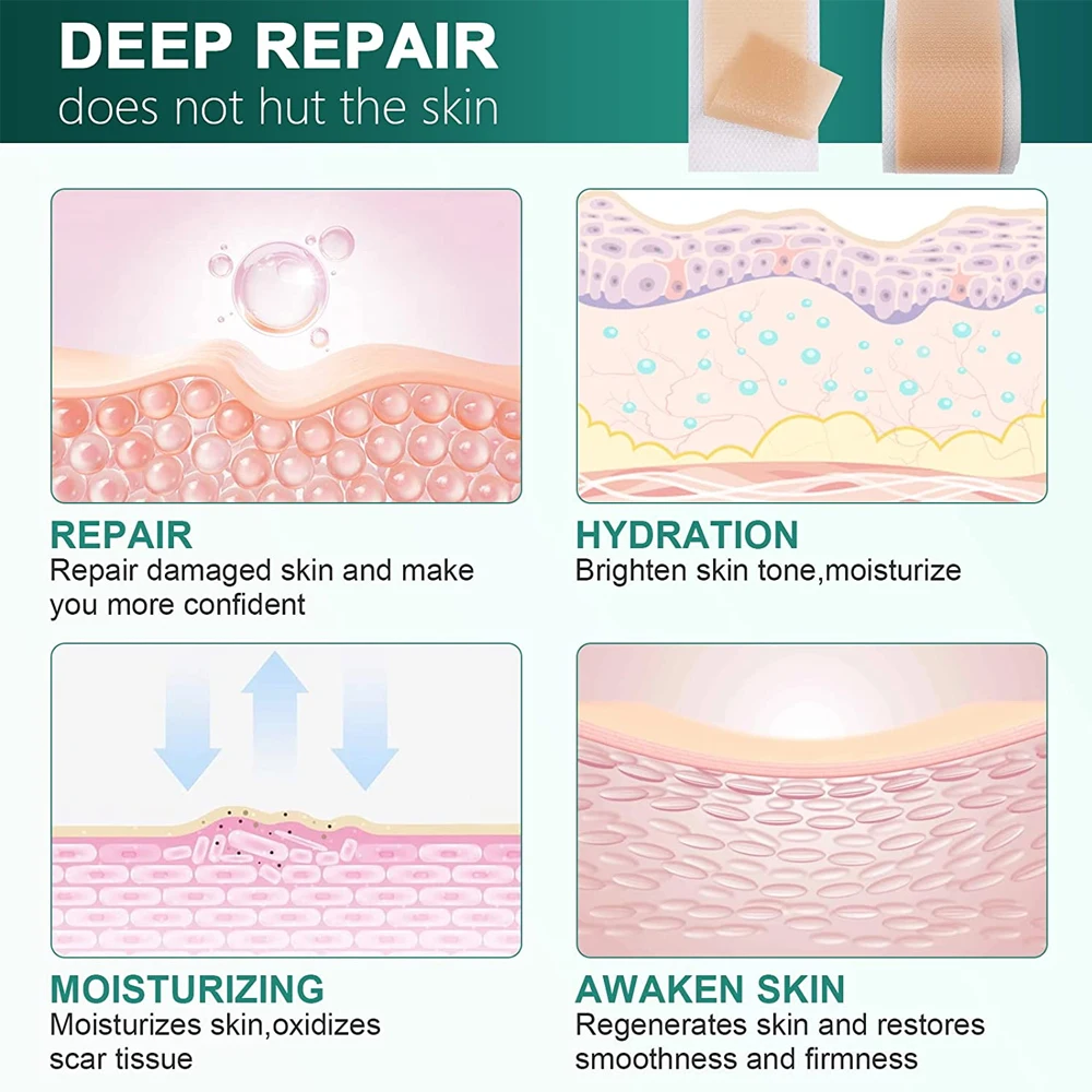 1 لفة شرائط إزالة صفائح الندبات السيليكون، علاجات تقليل الندبات للندوب الجراحية، القسم C، رقعة علامات التمدد بعيدا الجرح #6