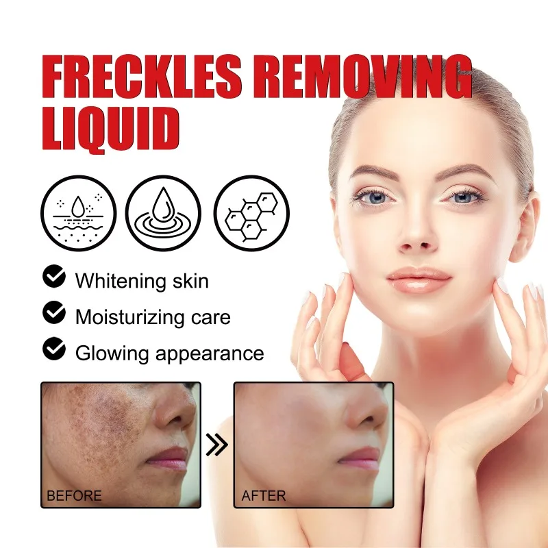 Freckles Removing Liquid Pore Shrink Moisturizing Remove Freckle Spots Blackheads Shrink Pores Oil Control Facial Skin Serum