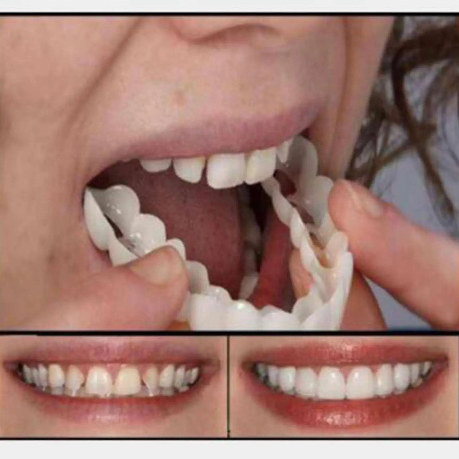Cosmetic Teeth Veneers Adjustable Snap in Dental Prosthesis for Teaching Models and Instant Whitening Effect