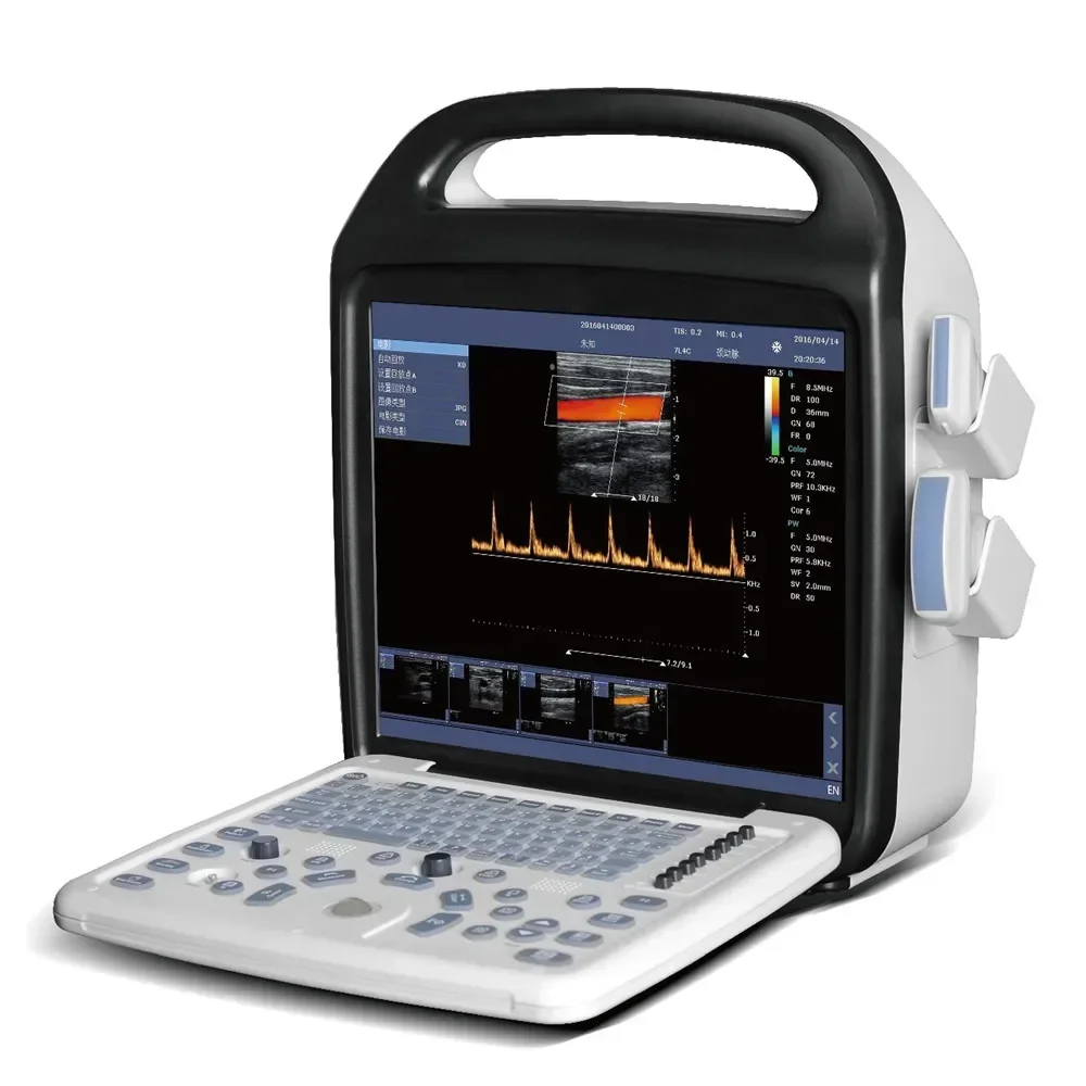 Portable medical ultrasonic instruments for hospital ultrasound Doppler and gynecological three-dimensional color