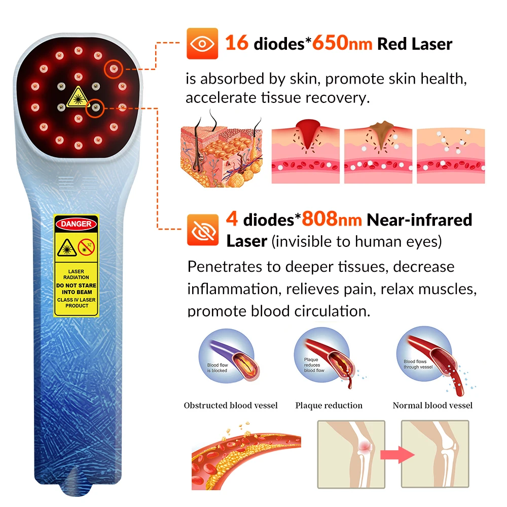 Рисунок 3 - Устройство для лазерной терапии