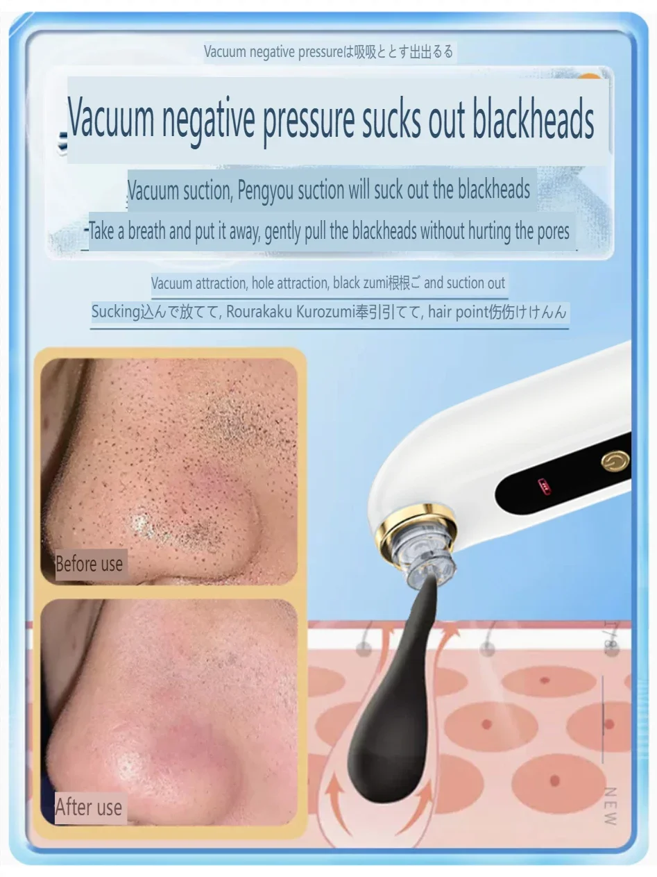 Electric Blackhead Beauty Device Painless  Does Not Hurt The Skin Clean Pores USB ML-009
