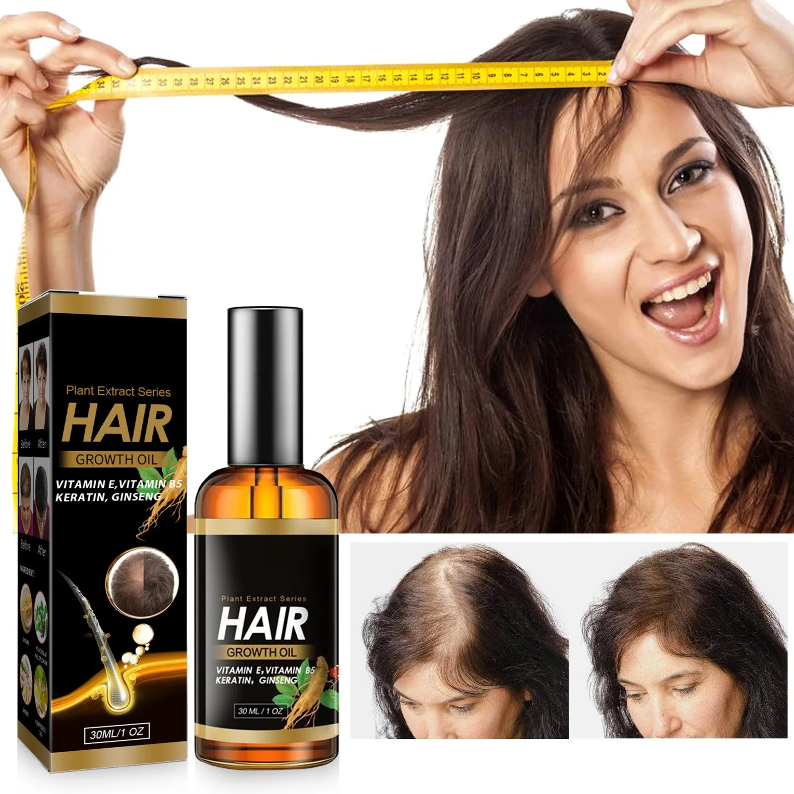 

30ml Hair Loss Regeneration Liquid And Nourishing Scalp Conditioner Reduce hair loss,hair follicle vitality,promote hair growth