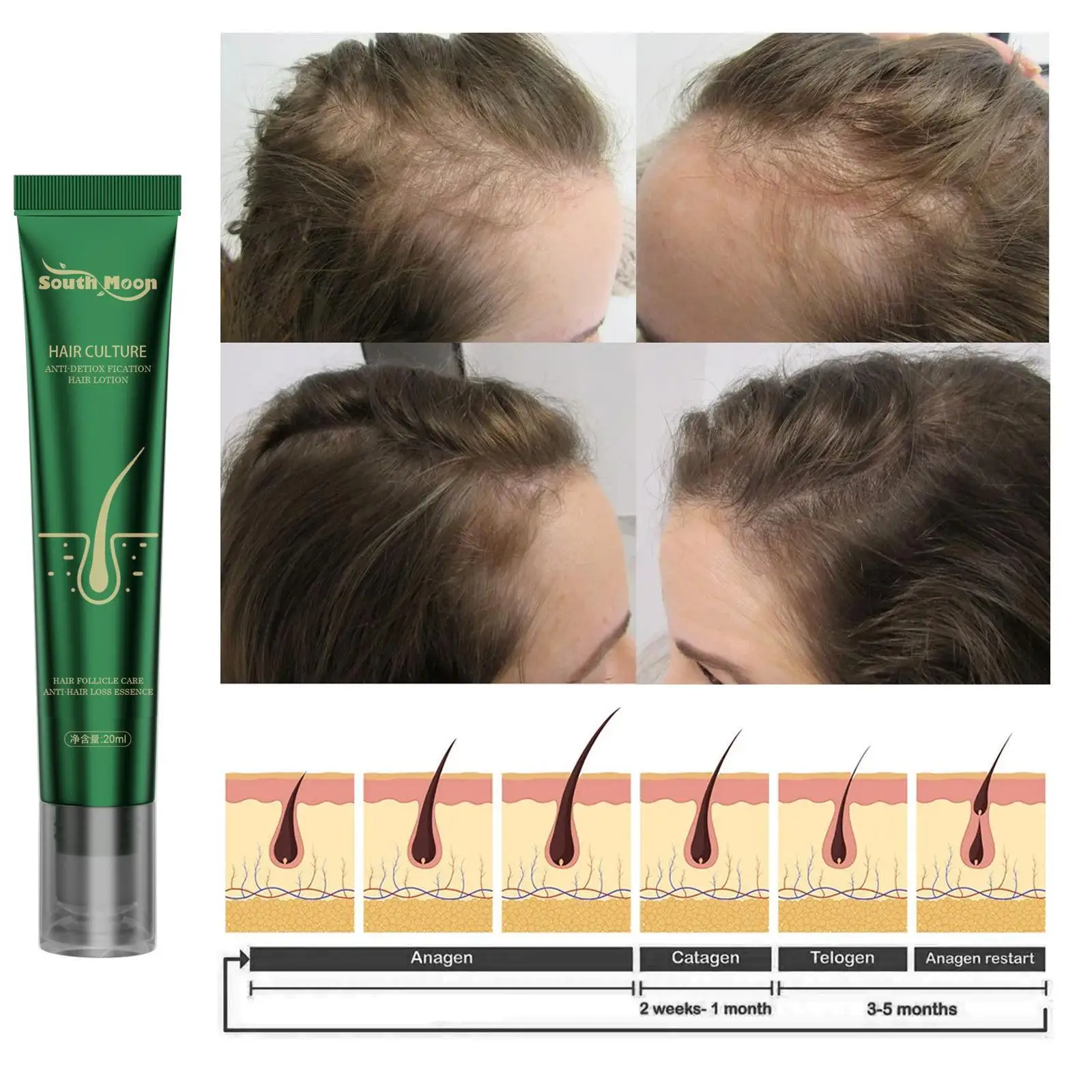 

Biotin Fast Oil Hair Regrowth Serum Hair Thinning Treatment Liquid Anti-Hair Loss for Women and Men