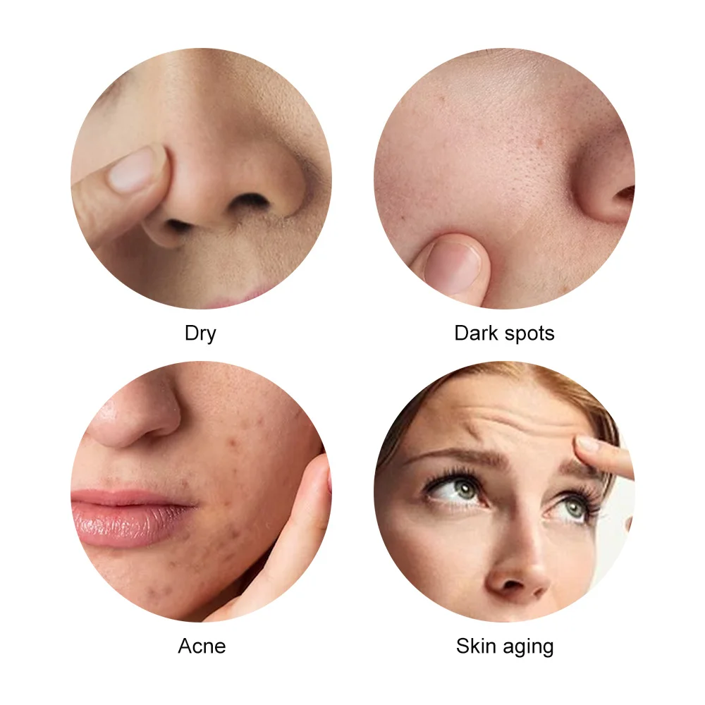 Ultrasone Machine Mini Hifu Machine Rf Fadiofrecuencia Ems Microcurrent Lift Stevige Aanscherping Huid Rimpel Schoonheid Tools