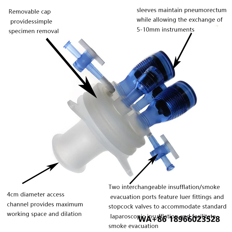 seemine-transanal-sterile-a-port-unique-pour-l'intervention-transanal-minimiquement-invasive-tamis-pour-l'excision-endoscopique-video-assistee-transanal