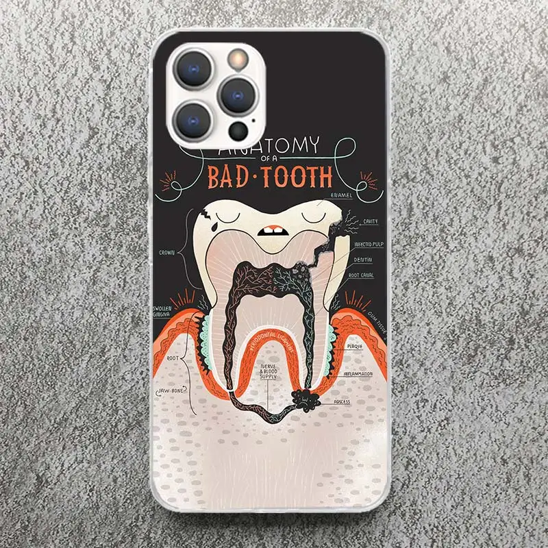 Wisdom Teeth Dentist Tooth Phone Case For Apple iPhone 16 15 14 13 12 11 Pro Max Mini XS XR X 7 Plus 8 + SE Soft Silicone Print 