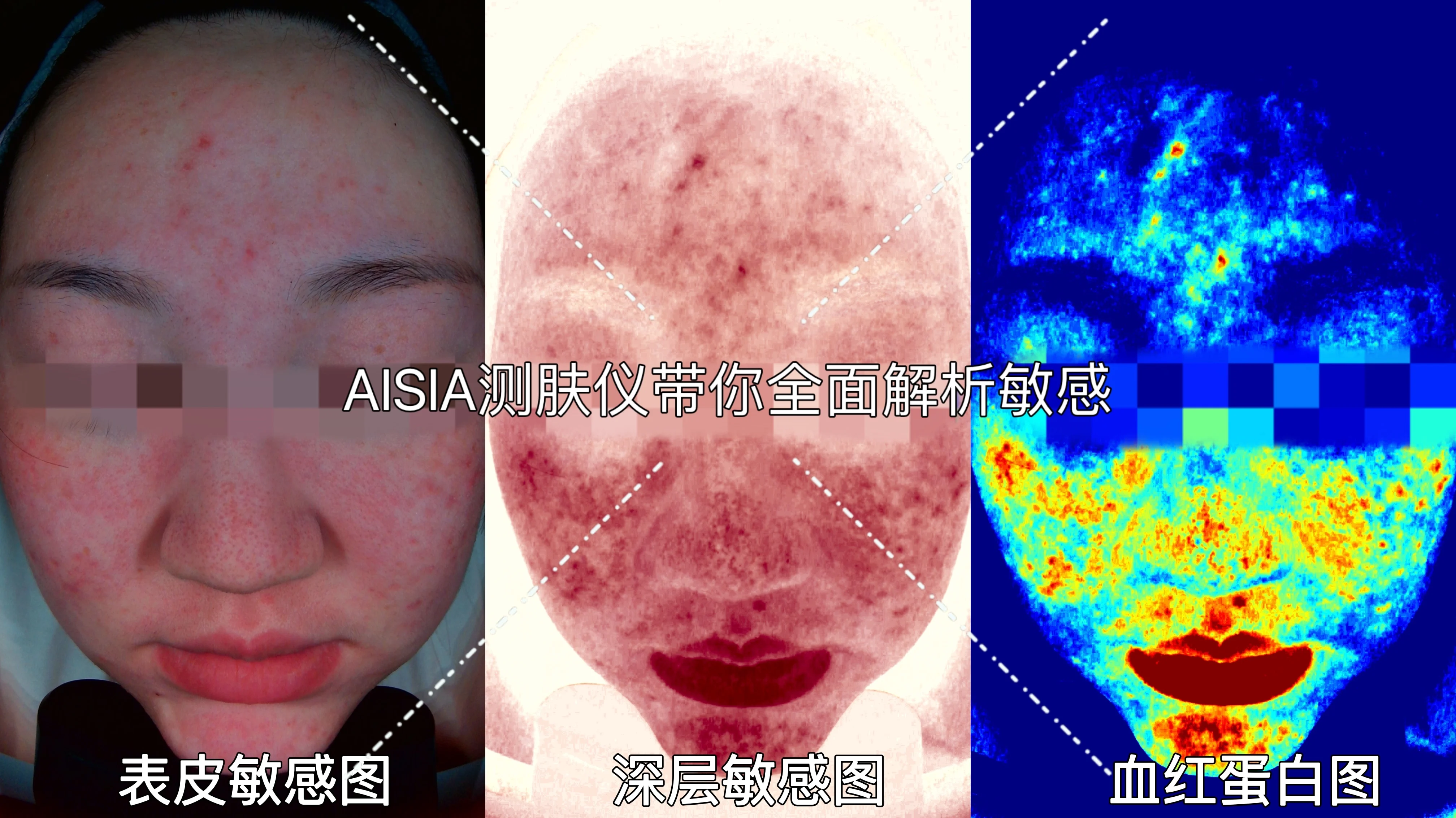Professional Skin Analyzer Machine Facial 3 D Skin Problem Deep Detection Explaination Machine Facial Skin Analyzer