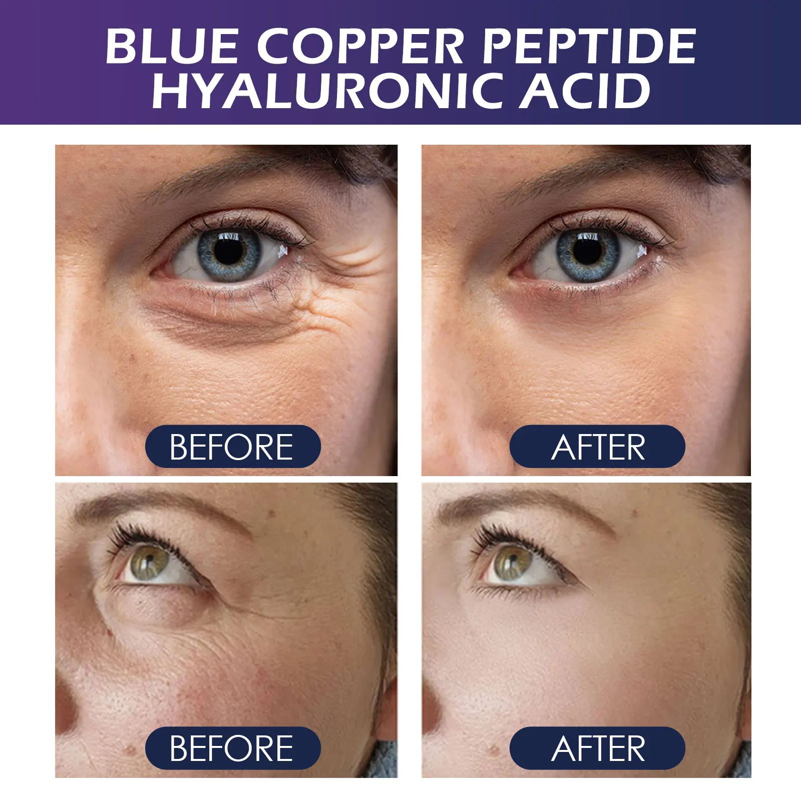 Blue Copper Peptide Hyaluronic Acid Essence Reduce Fine Line Improve Eye Bag Dark Circle Firm & Moisturize Facial Care Product