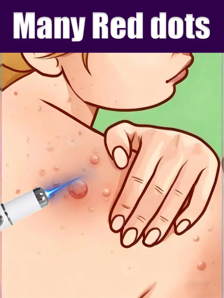 

Latest wart care tools for comprehensive cleaning and smoothing