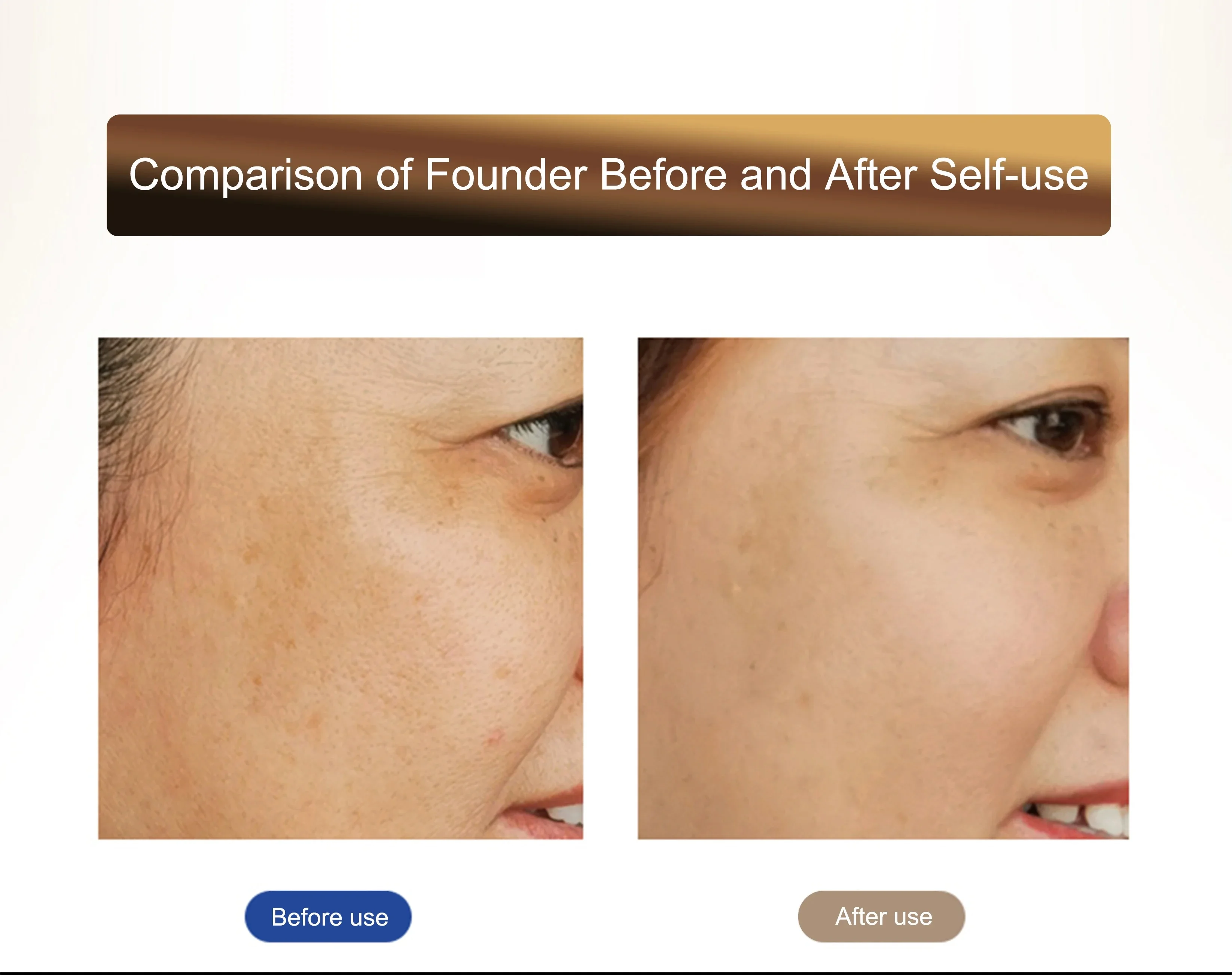 EMS美容器 女性用フェイスケアツール アイケアツール 美容機器 スキンケアデバイス 美容機器