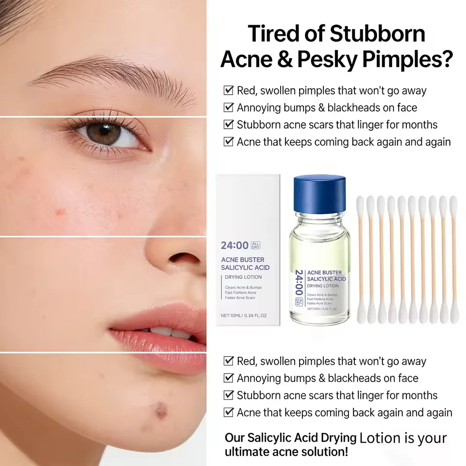 Sérum de Tratamento para Acne - Tranexamic Acid Serum avaliação e preço