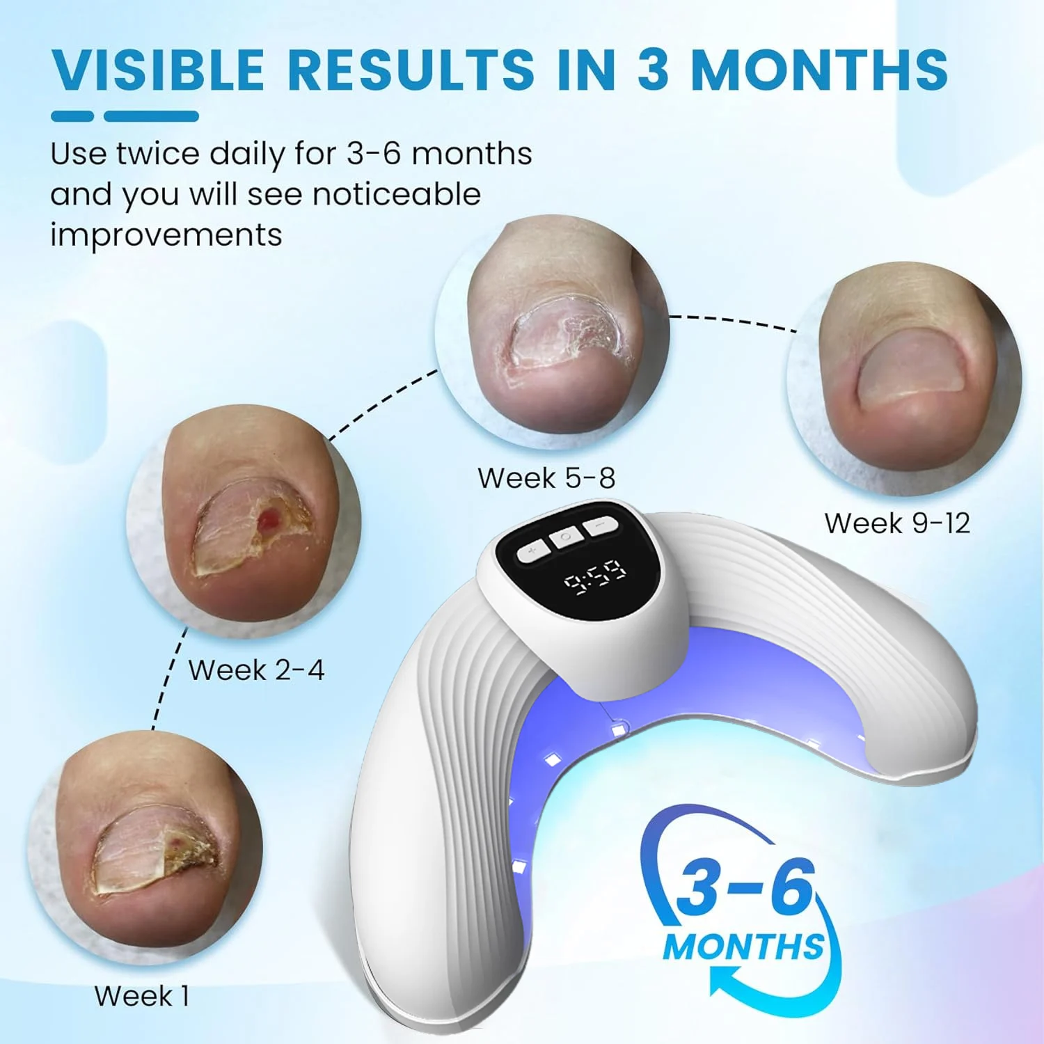 Led Nail Art Lamp Auto On Effectively Remove Nail Fungal Light Fingernail Fungus Treat with Display Curing Lamp