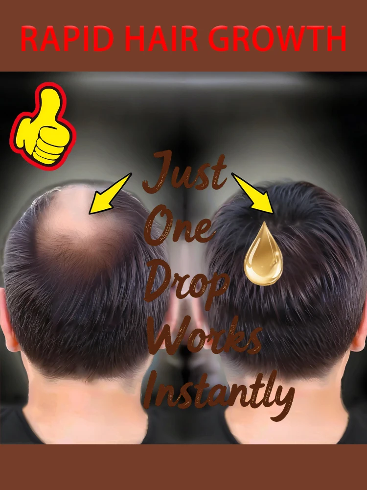 

Wɪᴛɴᴇss ᴛʜᴇ ᴍɪʀᴀᴄʟᴇ! Hᴀɪʀ ɢᴇɴᴇʀᴀᴛɪɴɢ ᴇssᴇɴᴄᴇ, ᴀ ᴅʀᴏᴘ ᴏғ ᴡʜɪᴄʜ ᴄᴀɴ ᴀᴡᴀᴋᴇɴ sʟᴇᴇᴘɪɴɢ ʜᴀɪʀ ғᴏʟʟɪᴄʟᴇs ᴀɴᴅ ɢʀᴏᴡ ɴᴇᴡ ʜᴀɪʀ ᴄʀᴀᴢɪʟʏ