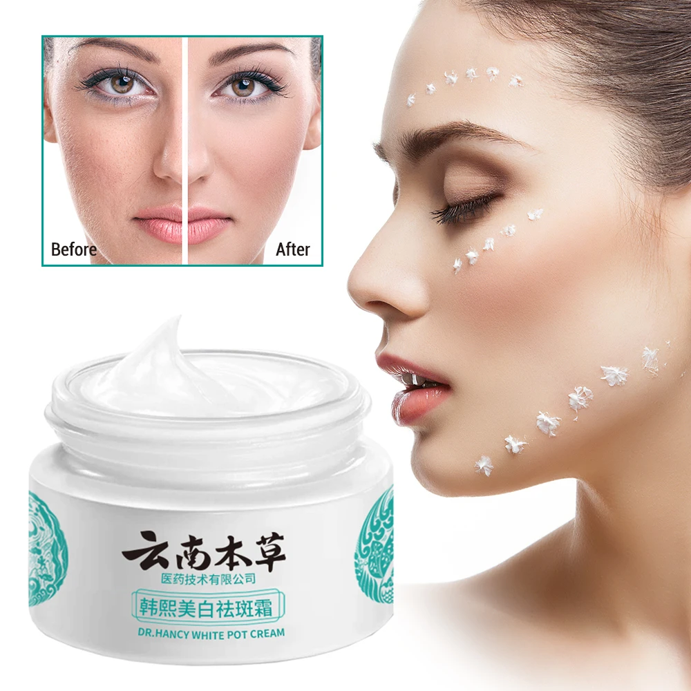 20g Face Freckle Removal Cream Whitening Moisturizing Nourishing Brightening Block Melanin Dilute Spots Repair Skin Lightening