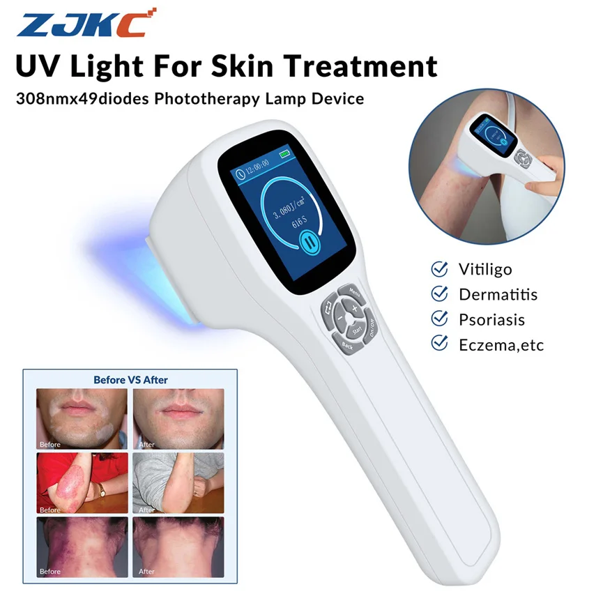 ZJKC 308nm Excimer Vitiligo Therapie Ultraviolet Uvb Blauwlichttherapie voor huidziekten Behandeling Fototherapie 49 Diodes