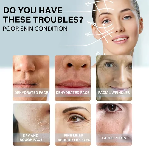 Imagen 2 del producto Línea de proteína dorada, relleno Facial reafirmante antiarrugas, sin aguja, absorbible, se desvanece, líneas finas, hilo de colágeno, suero antienvejecimiento, 60 uds.