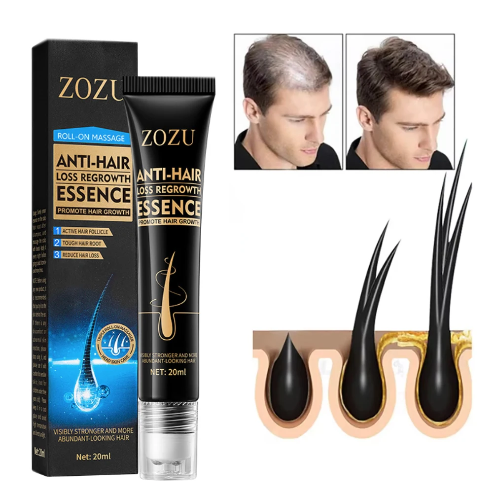 Fast Hair Growth Serum Cheveux Pousse Rapide Tratamiento Para El Cabello Porost Włosów Haarwachstum Cabelo Crescimento Rápido