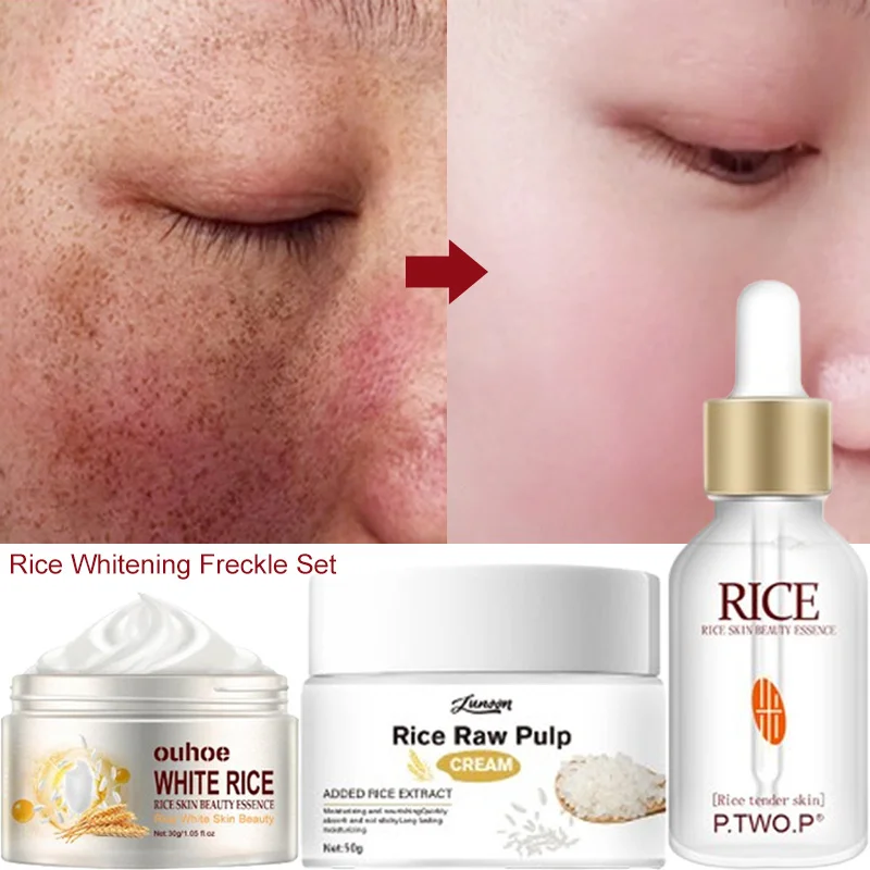 

Rice Whitening Freckle Set Face Cream Remove Dark Spots Fade Melanin Pigmentation Serum Reduce Fine Lines Brighten Moisturizing