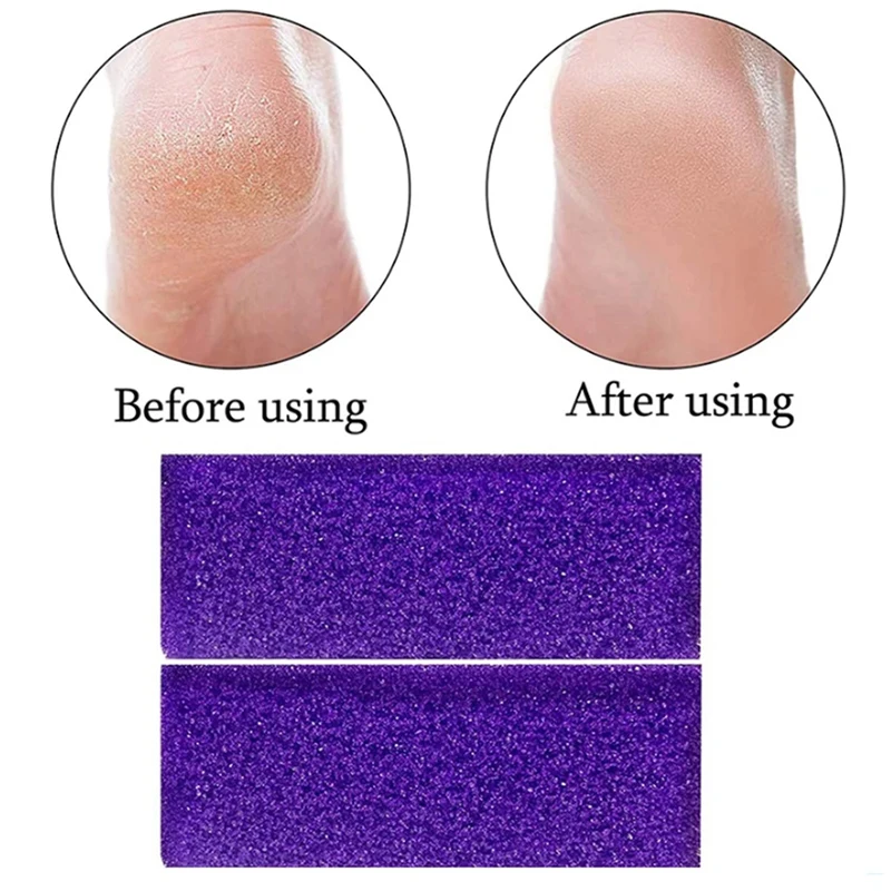 

5pcs Reusable Pumice Sponge Stones Foot Care Callus Exfoliate Hard