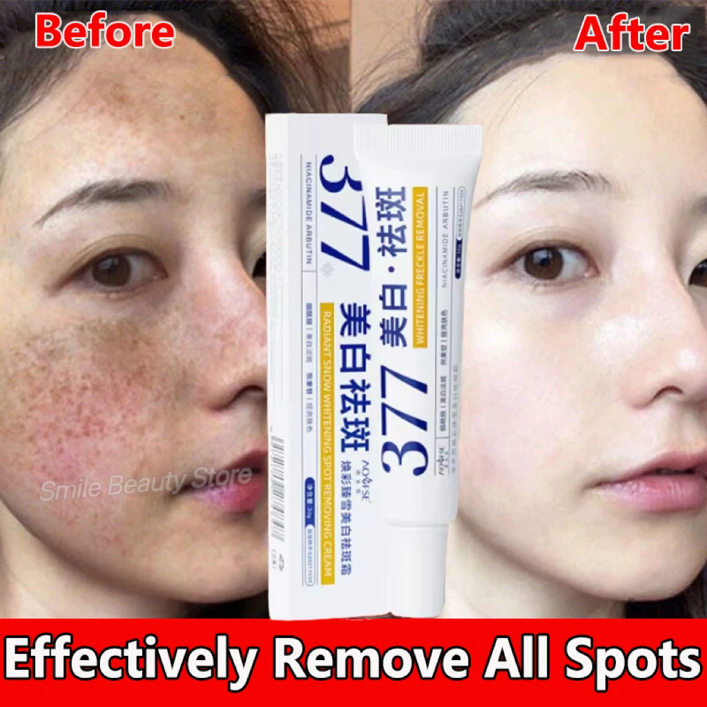 Fast Whitening Freckles Face Cream Remove Melasma Dark Spots Lighten Melanin Acne Scar Anti-aging Brighten Skin Care Products