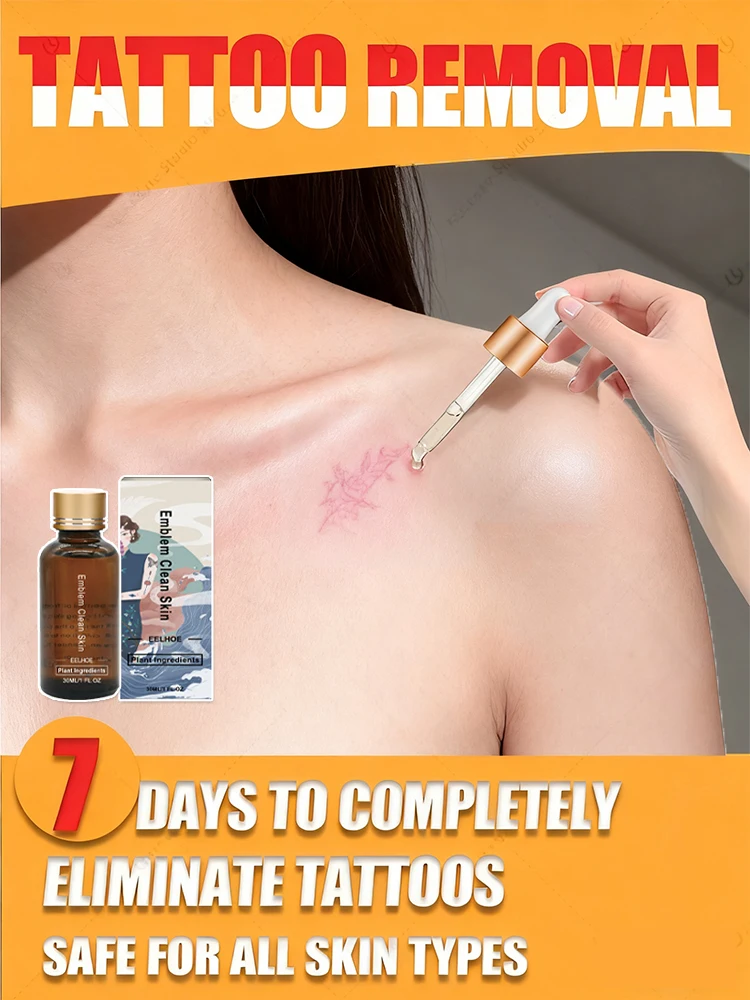 قم بإزالة الوشم في 7 أيام فقط #1