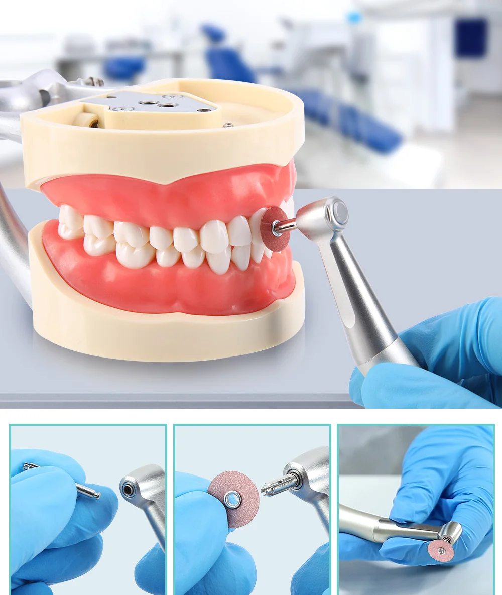 JOY DENTAL 50 Stück/40 Stück Dental-Finishing- und Polierscheiben für Komposite, Keramik und Glasionomer-Restaurationen 135 ℃ Autoklave – Detail 5