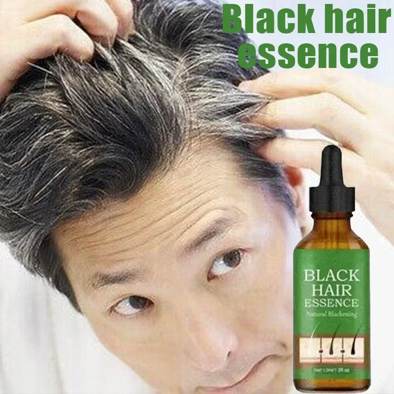 Health with Anti-Grey Hair Essence Serum Treatment Revitalize Your Ahair Essence Serum Treatment Restore Natural Hairand 23 0903