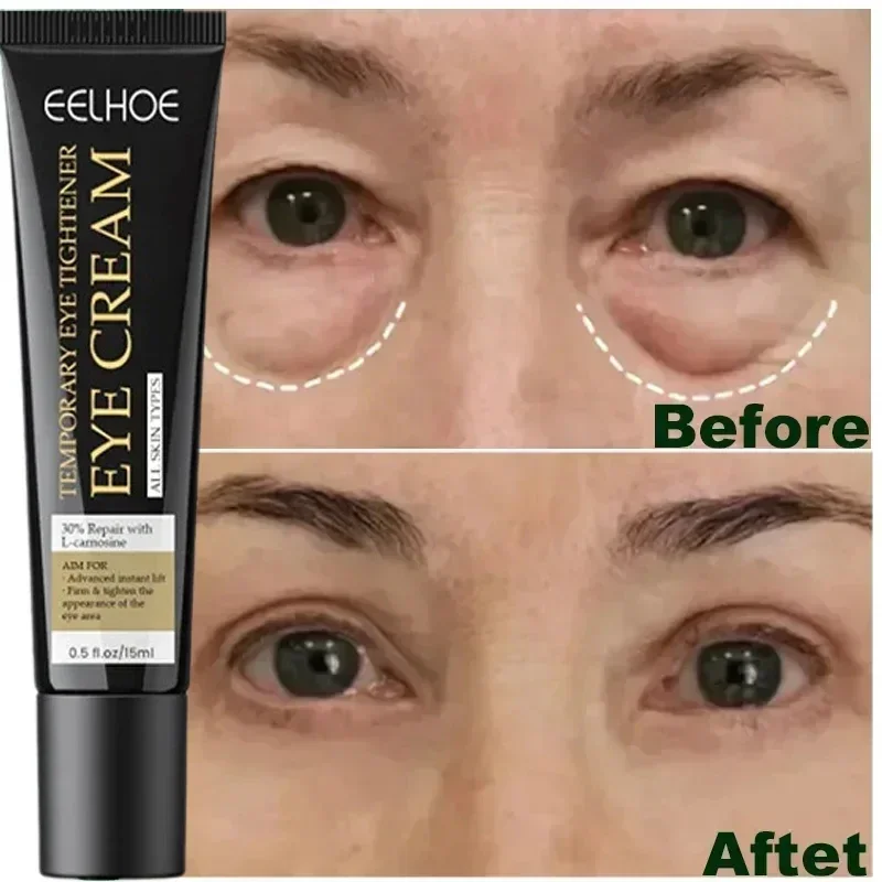 

7 Day Tighten Wrinkles Eye Cream Remove Eye Fat Bags Puffiness Lifting Firming Smooth Eye Massage Cream Nourish Eye Skin Care