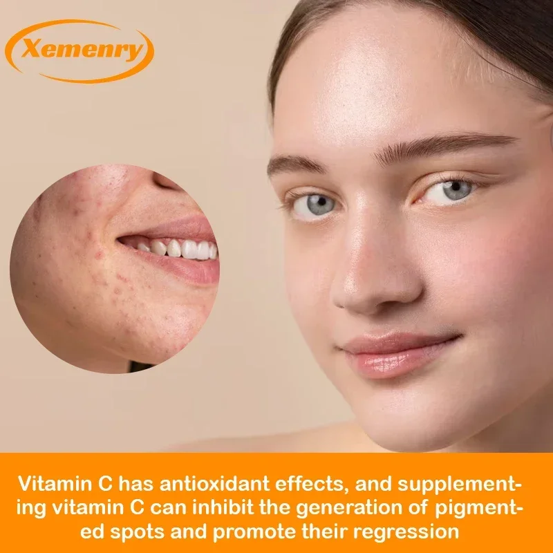 Vitamin C 1000mg - Improve Immunity, Promote Nutrient Absorption, Anti-oxidation