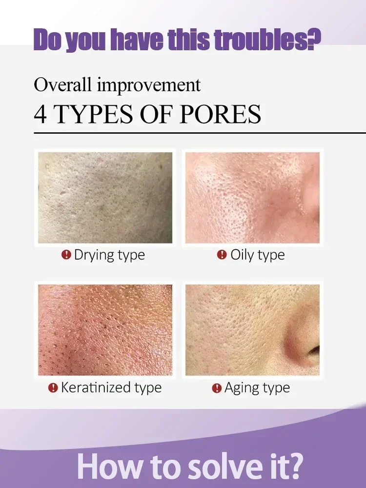 Pore Shrinking Serum Peeling Face Removing Large Pores Tightening Repairing Facial Pore Minimizing Effective Exfoliation Skin