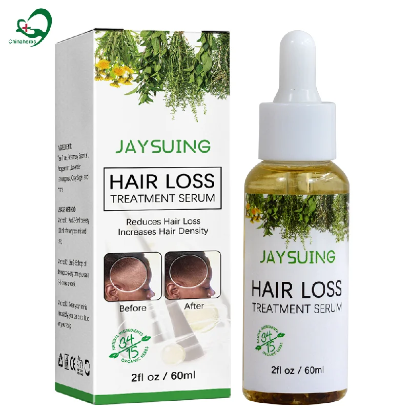 private label Rosemary Hair Growth oil product for black women scalp essential serum organic rose mary treatment for wild bald