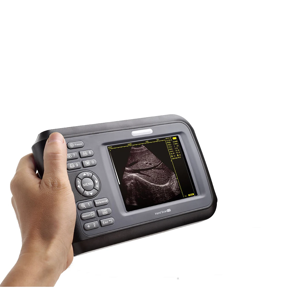 

Medical Handheld Full Digital Portable Veterinary Ultrasound Scanner Machine V8 Ultrasound Machine