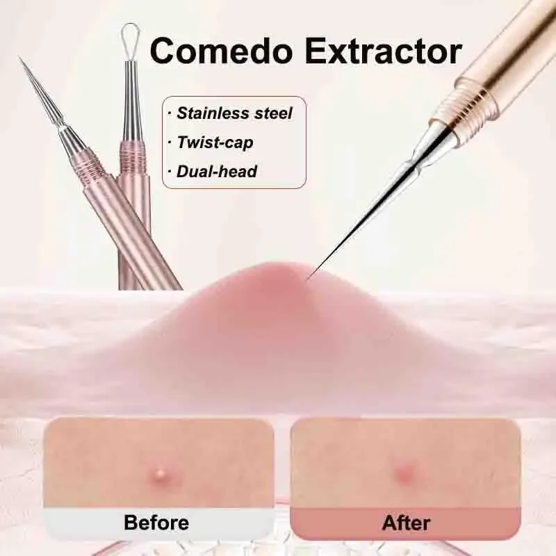 Extracteur de points noirs, comédon, acné, boutons, imperfections, aiguilles en acier inoxydable, outils pour enlever le visage, soins de la peau, nettoyeur de pores