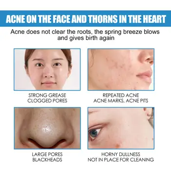 센텔라 아시아티카 리페어 크림은 수분 공급, 피부 신진대사 촉진, 피부톤 개선, 피부 재생, 모공 축소, 여드름 제거에 도움을 주는 크림입니다. 6 best sales 모공 제거 크림 - №4